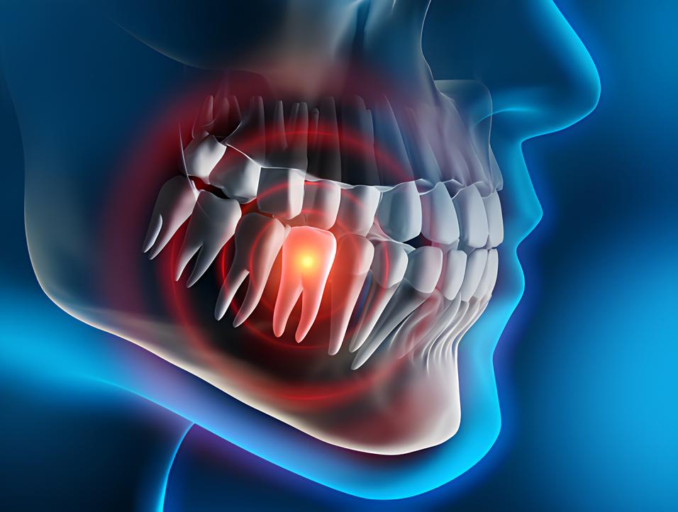 Teeth image - Emergency dentist Mansfield